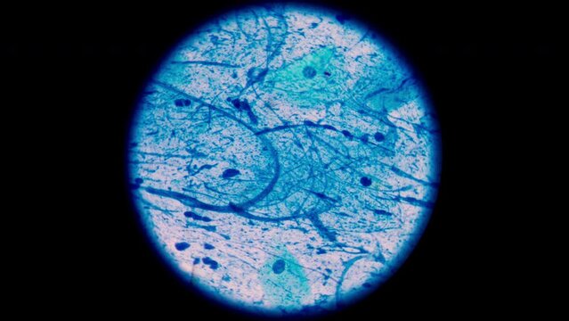 AFB Negative and Positive in stop motion footage.