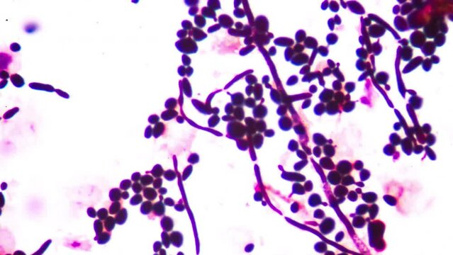 Yeast cells stop motion.