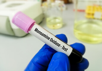 Monoamine oxidase (MAO) test, a class of antidepressants drug.