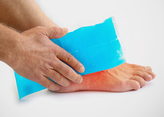Man using cool gel pack on a swollen injured ankle with Color Enhanced skin with red spot...