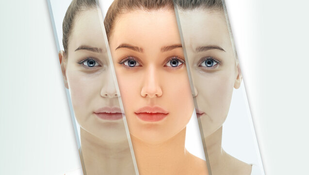 Effects of ageing,Frownscowl lines ,Nasolabial folds,Neck ,Under eye circles,neck lines. Plastic Surgery Results