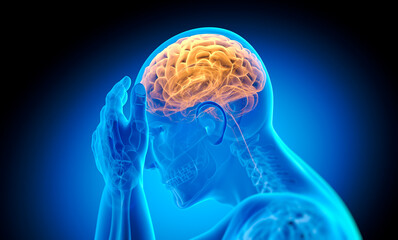 Man with brain disorder - 3D illustration - 515398435