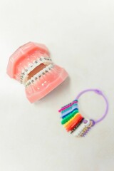 Top view of model teeth with orthodontic braces and a chain displaying different color options