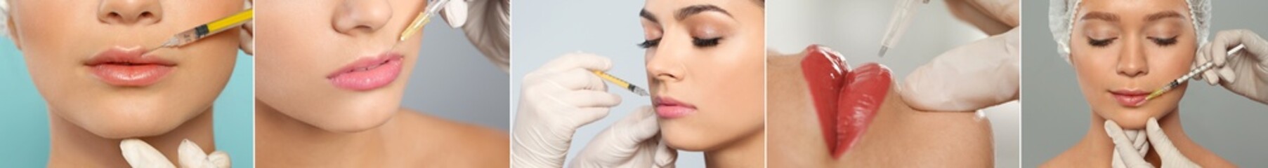 Collage with photos of women during procedures of lip augmentation and permanent makeup, closeup....