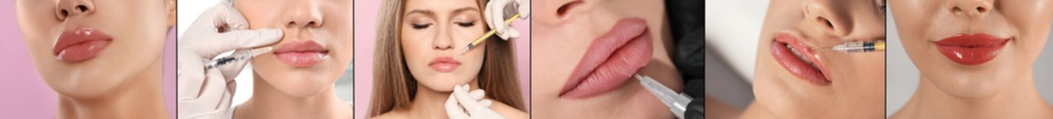 Collage with photos of women during procedures of lip augmentation and permanent makeup, closeup....