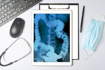 X-ray image of the gastrointestinal tract in a tablet. The concept of telemedicine and diagnosis of...