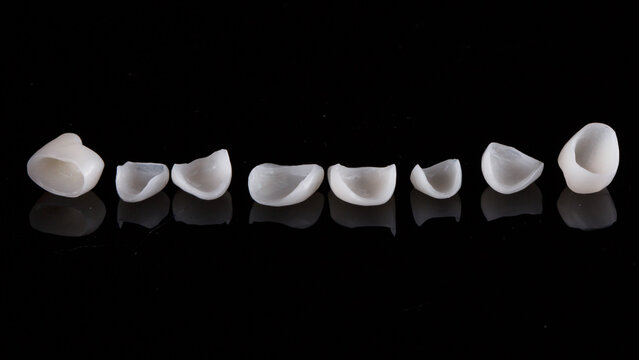 laid out thin dental veneers from ceramics on a black background
