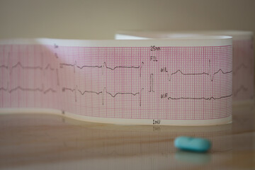 Electrocardiogram tracing with selective focus on a table. Study of the heart recorded on paper.