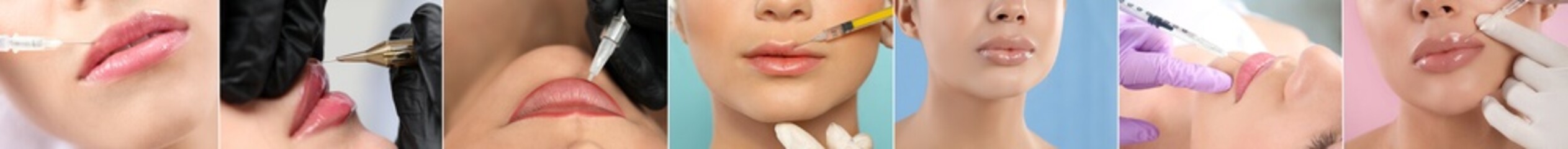 Collage with photos of women during procedures of lip augmentation and permanent makeup, closeup. Banner design - obrazy, fototapety, plakaty