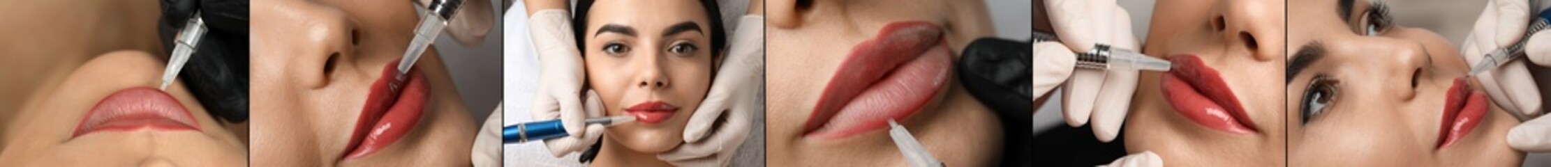 Collage with photos of women during procedures of lip augmentation and permanent makeup, closeup. Banner design - obrazy, fototapety, plakaty