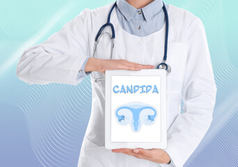 Doctor holding modern tablet with word Candida and illustration of female reproductive system on...