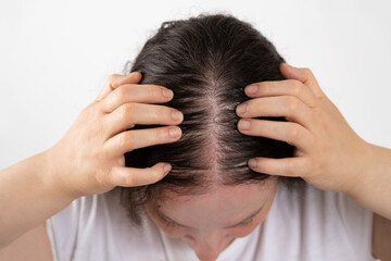 Close-up of woman controls hair loss and little volume with fine hair against a white background...