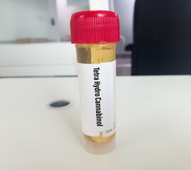 Urine sample for Tetrahydrocannabinol(THC) test. THC toxicology screen urine tests for doping and...