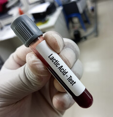 Blood sample for Lactic acid test, to diagnosis inadequate amount of oxygen in cells and tissues...