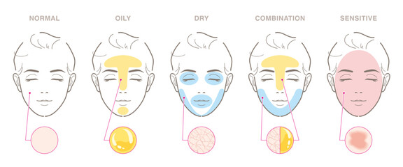 Types of women's skin problems. Normal, oily, dry, combination, sensitive. Vector illustration isolated on white background.