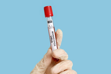 Fototapeta premium Hand of scientist with sample of monkeypox virus on blue background, closeup
