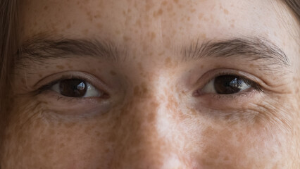 Fototapeta premium Cheerful freckled young woman looking at camera, upper cropped face view. Close up shot of happy optimistic female with spotted facial skin. Skincare, natural beauty, eye care, vision check up concept