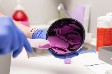 A dentist woman's hands mixing the paste to make a mold for a plaster denture of one of her clients...