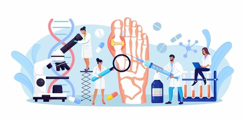 Gout treatment. Arthritis joint in the ankle. Doctor diagnoses swollen and inflamed foot joint. Physician examination human feet bone with uric acid crystals. Medical appointment and exam