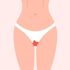 Woman thighs with blood-stained panties. Period power. Menstruation day. Menstrual protection concept. Vector illustration in trendy flat style.