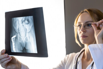 An orthopedic doctor examines an X-ray after surgery. X-ray of the hip joint. Focus on X-ray