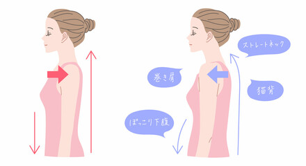 まっすぐした姿勢と猫背の女性のイラストセット