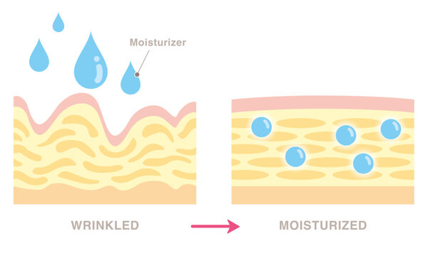 Cross section of wrinkled skin and moisturized skin. Pale colored illustration in flat cartoon style.