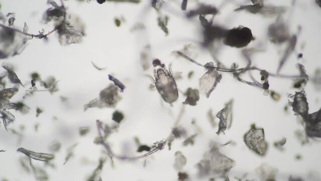 顕微鏡で拡大したハウスダストとダニ