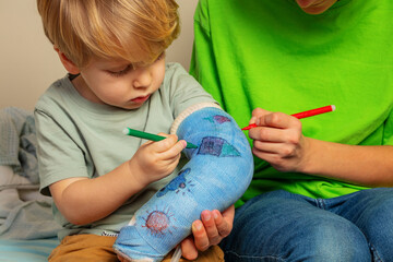Boy and brother draw broken hand plaster cast using felt-tip pen