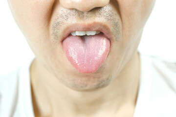 Fototapeta premium Close-up of a young man. He sticks his tongue out of his mouth to show his tongue. health and medical concepts
