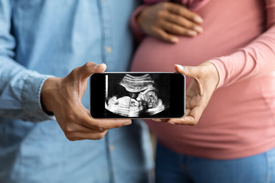 Black pregnant couple holding smartphone with baby ultrasound image, closeup - Powered by Adobe