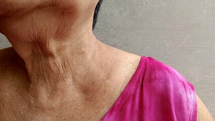 The skin of the neck of the elderly is wrinkled.