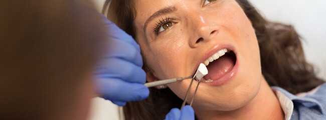 Young woman checking her teeth at the dentist clinic