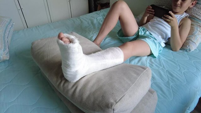 Little boy with broken leg in plaster. Lying on bed at home