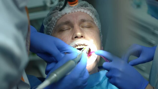Close-up man in dental chair with doctor and nurse using drill and sucking tube in slow motion. High angle view portrait of ill Caucasian patient with toothache in hospital with dentist and assistant