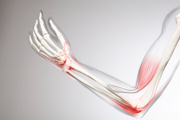 Human elbow pain, arm and bone 