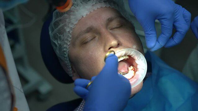 Close-up patient with mouth retractor in dental chair and surgeon stitching mouth gum in slow motion. Professional unrecognizable dentist suturing wound of patient in hospital