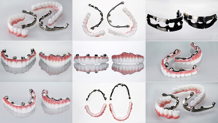 dental collage of different photos of two prostheses and titanium bars in different compositions on...