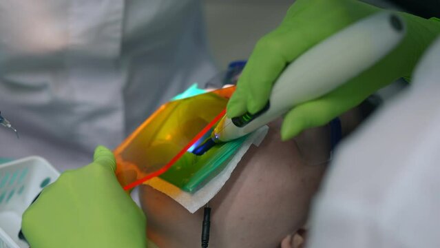 Close-up dental assistant using dental curing light in slow motion in stomatological clinic. Unrecognizable Caucasian professional woman doing polymerization of light-cure resin-based composites