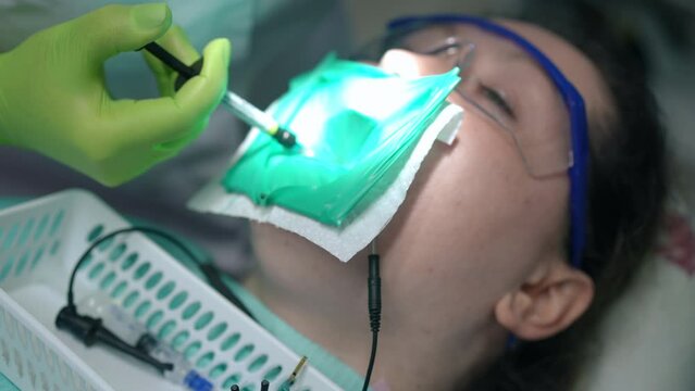 Dental assistant hands leaving with UV curing light and unrecognizable dentist inserting filling in tooth. Caucasian professional women treating ill patient in dental chair in hospital. Slow motion