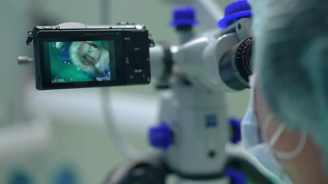 Close-up dental microscope screen with tooth cavity and blurred doctor on the right. Unrecognizable professional dentist using modern device for endodontic treatment in medical clinic. Slow motion