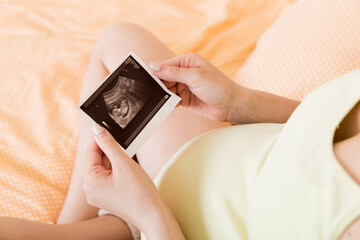 Pregnant Woman sitting on bed and Looking At Ultrasound Scan photo of her Baby. A pregnant female...