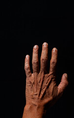 the surface of the hand