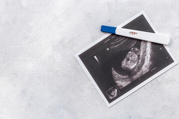 Positive pregnancy test with ultrasound picture of unborn baby