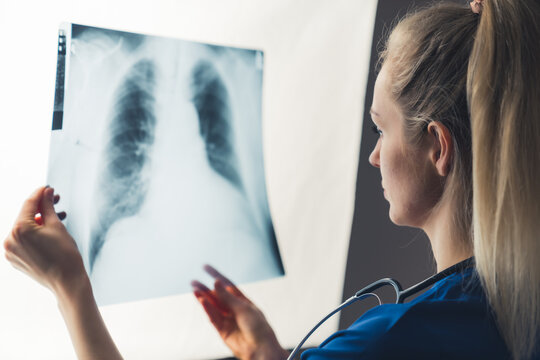 Closeup shot of an unrecognizable young adult caucasian female doctor holding lung x-ray, examining her patient's results. Healthcare professionals. High quality photo