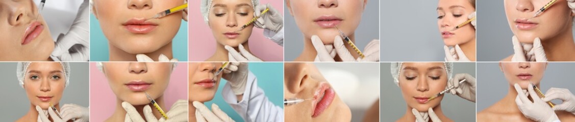 Collage with photos of woman during lip augmentation procedure. Banner design