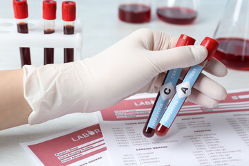 Scientist holding tubes with blood samples for hepatitis virus test near laboratory form, closeup