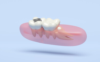 dental examination of the dentist, 3d wisdom teeth model problems icon with gums isolated on blue background. health of white teeth, oral care, 3d render illustration