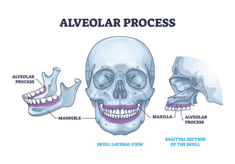 Alveolar process with anatomical head bone ridge for teeth outline diagram. Labeled educational scheme with chin maxilla and mandible parts vector illustration. Dental implant location on human skull. - obrazy, fototapety, plakaty