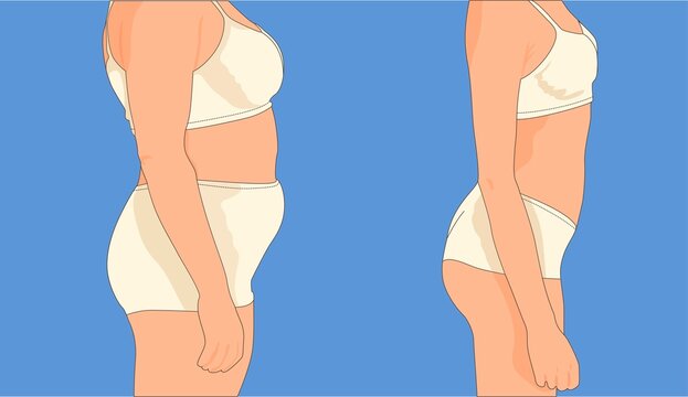 Figure befor and after from the side